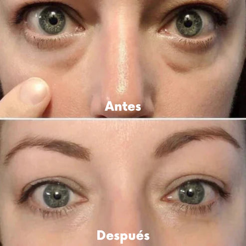 Lurina RedLift™ Elimina las ojeras y bolsas en 7 días